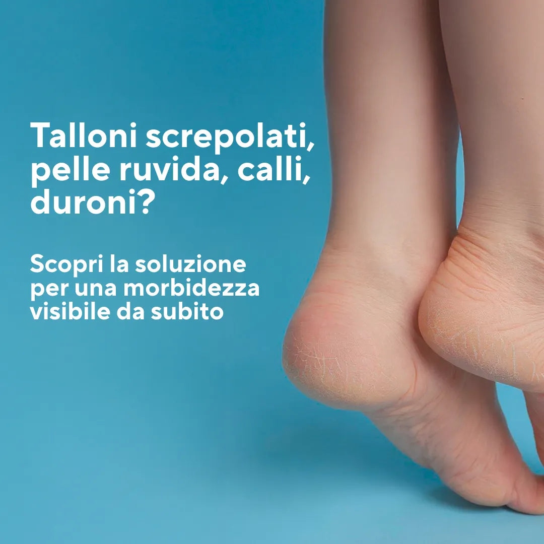 SOS Callus Feet